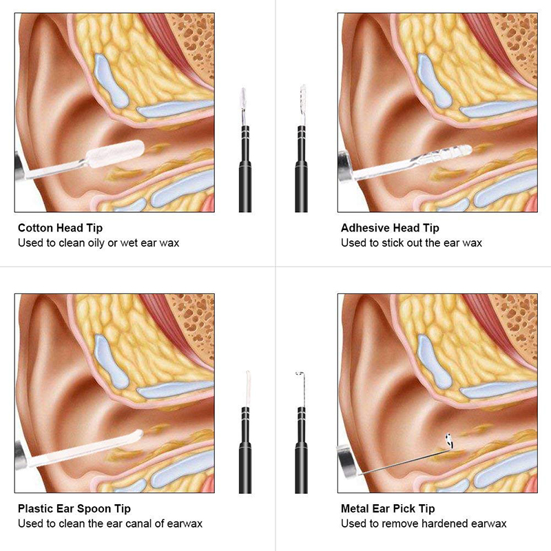 Wifi Otoscope 3 i 1 Uirlis Remover Céir Cluas 720P Ceamara Uiscedhíonach le 6 LED Inoiriúnaithe Ag luí le Android agus iOS