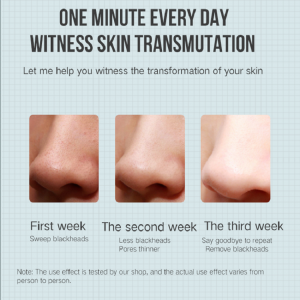 Extractor Extractor Acne Acne Acne Remover Blackhead Meaisín Áilleacht Phore Glan Glantóir